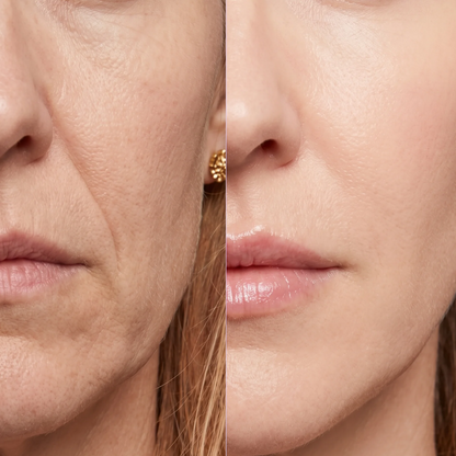 Collagen Volume Multi Balm Stick (Volufiline + PDRN + NAD)